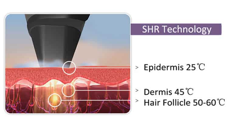 Diode hair removal laser in-motion shr