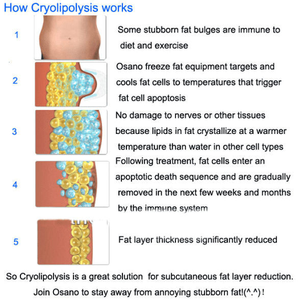 Cryolipolysisi machine