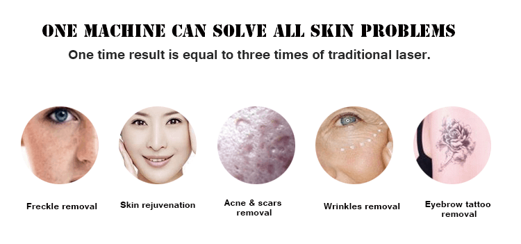picosure results