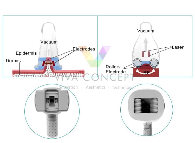 Velashape machine theory