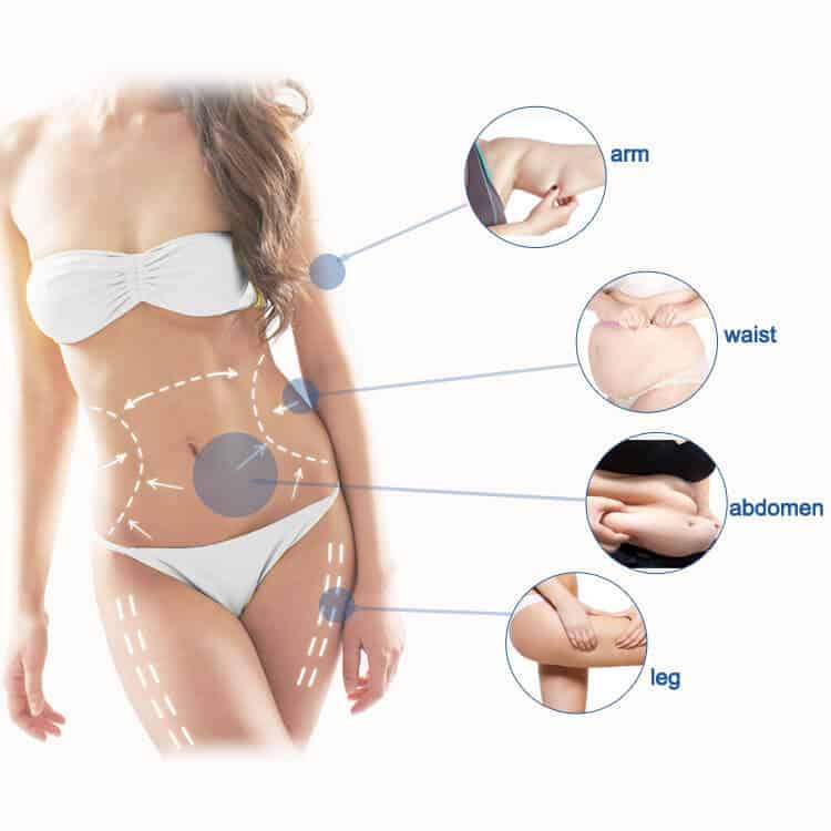 Liposonic Treatment