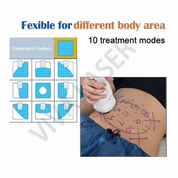 HIFU Liposonix treatment machine area