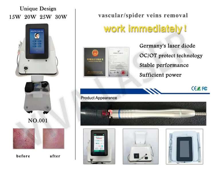 980nm diode laser spider vein removal machine 30w