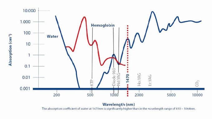 980nm diode laser machine absorption